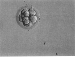 3 day embryo. reversed B