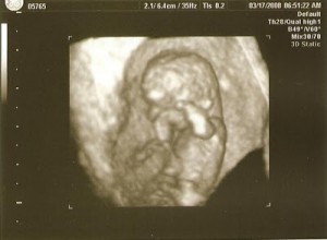 10w 6d Baby F Picture B