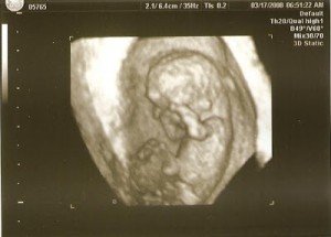 10w 6d Baby F Picture C
