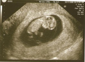 10w 6d Baby F Picture D