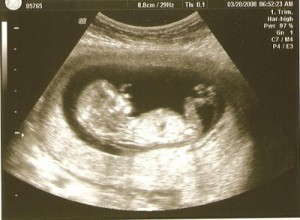 12w 3d Baby F Picture A
