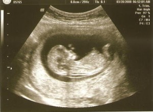 12w 3d Baby F Picture D