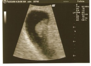 7 week ultrasound