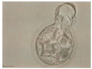 Frozen embryo Grade unknown 1.22.08 Baby H