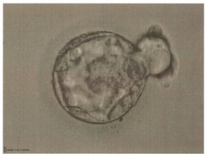 Frozen embryo Grade unknown 1.22.08 Baby I