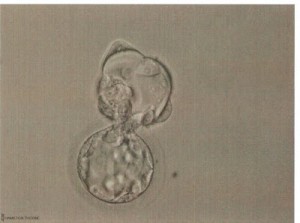 Frozen embryo Grade unknown 1.22.08 Baby K