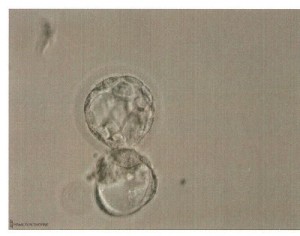 Transfered embryo Grade 5BA 1.22.08