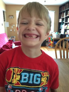 And Max lost another tooth!